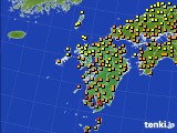 九州地方のアメダス実況(気温)(2016年09月28日)