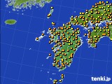 九州地方のアメダス実況(気温)(2020年10月02日)