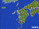 九州地方のアメダス実況(気温)(2020年10月13日)