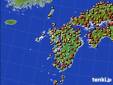 九州地方のアメダス実況(気温)(2021年07月11日)