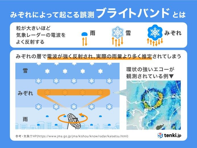 「ブライトバンド」の仕組み