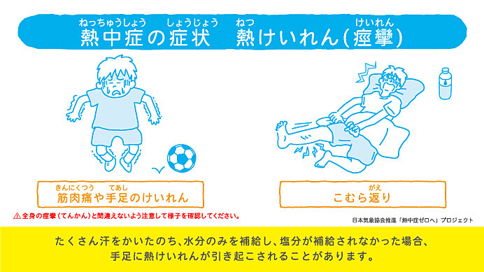 熱中症の症状　②熱けいれん