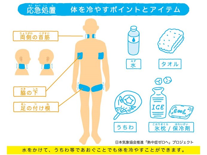 熱中症時の応急処置　体を冷やすポイントとアイテム