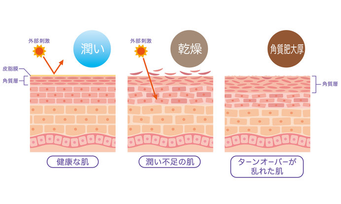 乾燥した肌は、外部の刺激に弱くなります。不要な角質は、くすみの原因に。