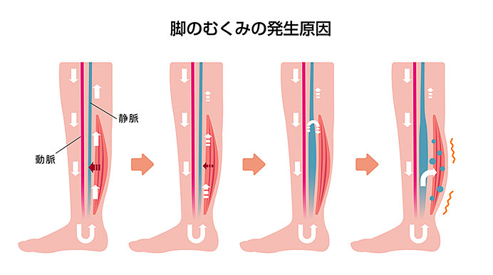 足 の むくみ 改善